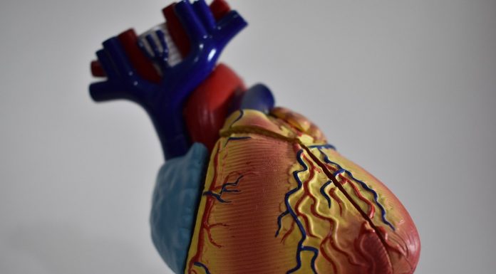 angina pectoris